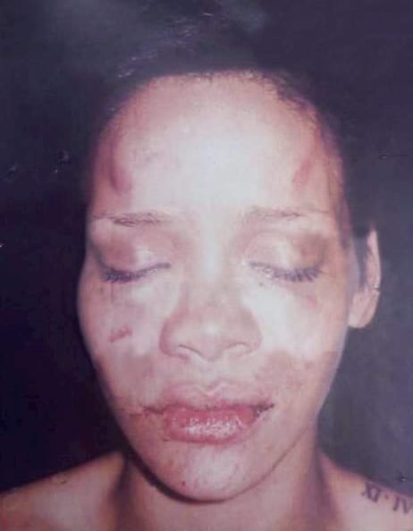 Chris Brown nach Verhaftung in Manchester, 2025